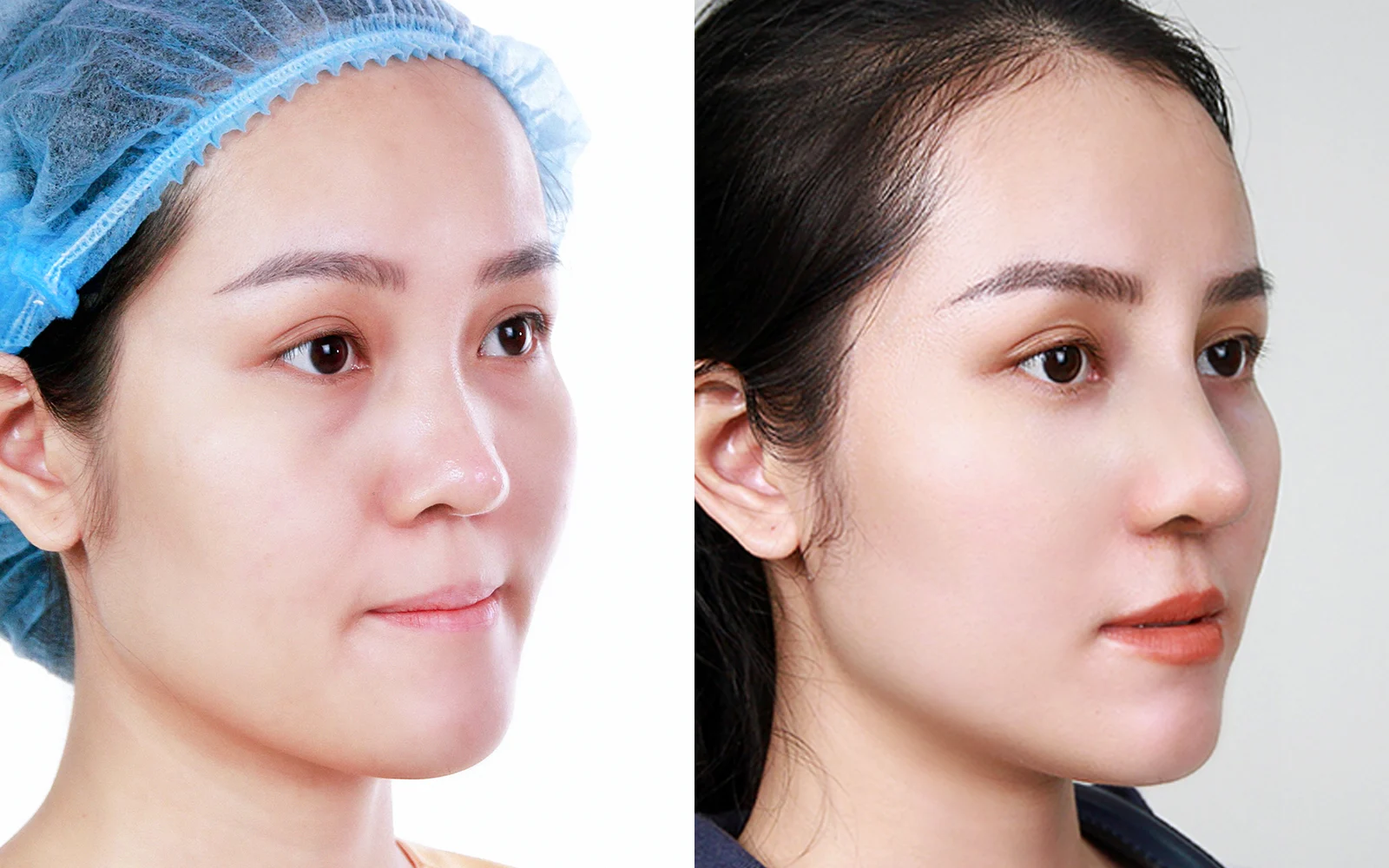 Before and after treatment detail view